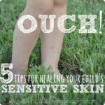 Ouch! {5 Tips for Healing Your Child’s Sensitive Skin} Image