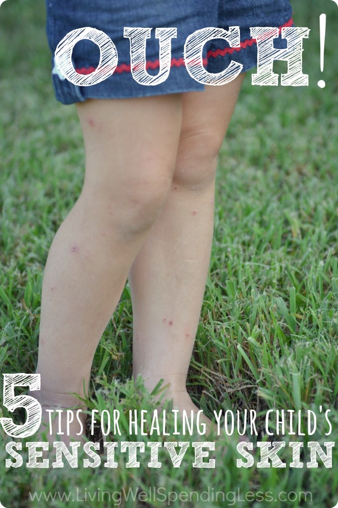 5 Tips for Kids' Sensitive Skin Living Well Spending Less®