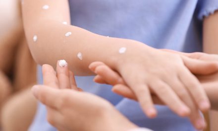 5 Tips for Healing Your Child’s Sensitive Skin